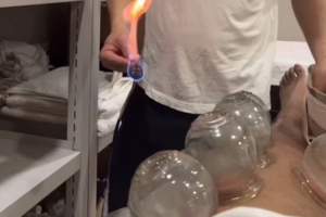 嘗試東方神秘力量！北京男籃外援斯佩爾曼曬拔火罐視頻