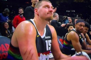 觸目驚心?。〖s基奇胳膊上的三道血痕是誰撓的？下手真狠啊??